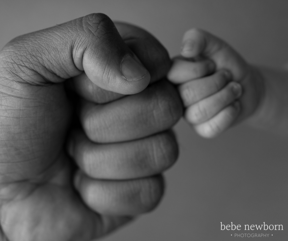 newborn photography for special needs babies